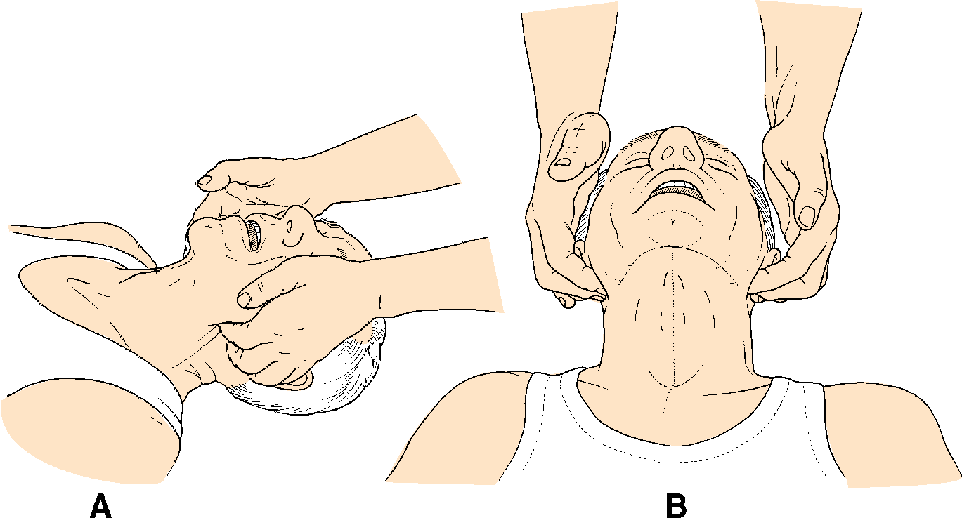 0x08 graphic